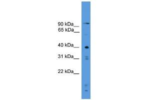 WB Suggested Anti-PRSS23 Antibody Titration: 0. (PRSS23 抗体  (C-Term))