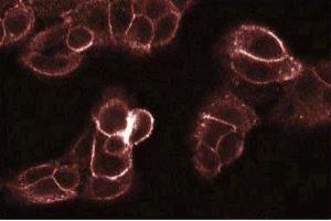 Immunofluorescence staining of A431 cells. (PKC theta 抗体  (AA 21-217))