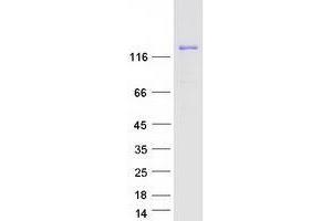 Western Blotting (WB) image for Unc-51-Like Kinase 4 (ULK24) protein (Myc-DYKDDDDK Tag) (ABIN2735010)