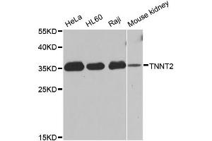 Western blot analysis of extracts of various cell lines, using TNNT2 antibody (ABIN5970474) at 1/1000 dilution. (Cardiac Troponin T2 抗体)