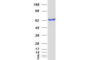 Western Blotting (WB) image for Estrogen Receptor 1 (ESR1) (Transcript Variant 1) protein (Myc-DYKDDDDK Tag) (ABIN2720537)