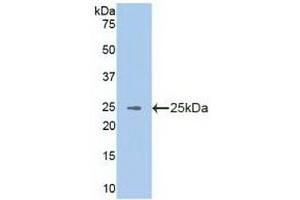 Detection of Recombinant VAV3, Human using Polyclonal Antibody to Vav 3 Oncogene (VAV3) (VAV3 抗体  (AA 398-583))