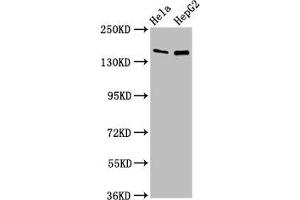 Western Blot Positive WB detected in: Hela whole cell lysate, HepG2 whole cell lysate All lanes: SULF1 antibody at 4 μg/mL Secondary Goat polyclonal to rabbit IgG at 1/50000 dilution Predicted band size: 102 kDa Observed band size: 150 kDa (SULF1 抗体  (AA 105-372))