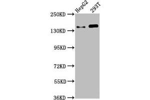 Western Blot Positive WB detected in: HepG2 whole cell lysate, 293T whole cell lysate All lanes: SMC5 antibody at 4. (SMC5 抗体  (AA 296-403))