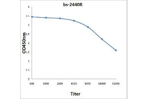 Antigen: 0. (IRAK4 抗体  (AA 21-120))