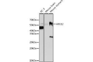 Western blot analysis of extracts of various cell lines, using  antibody (ABIN7265788) at 1:1000 dilution. (ATG12 抗体)