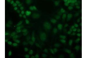 Image no. 2 for anti-Cyclin-Dependent Kinase 2 (CDK2) antibody (ABIN1497398) (CDK2 抗体)