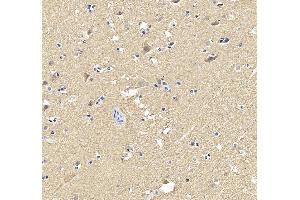 anti-Enolase 2 (Gamma, Neuronal) (ENO2) antibody