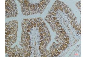 Immunohistochemistry (IHC) analysis of paraffin-embedded Mouse ColonTissue using AMPK a1 Mouse Monoclonal Antibody diluted at 1:200. (PRKAA1 抗体)