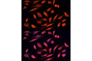 Immunofluorescence (IF) image for anti-serine/threonine Kinase 24 (STK24) (AA 312-431) antibody (ABIN6148602)