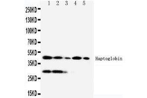 Anti-Haptoglobin antibody, Western blotting Lane 1:RAJI Cell Lysate Lane 2:HL-60 Cell Lysate Lane 3:HUT102 Cell Lysate Lane 4:JURKAT Cell Lysate Lane 5:CEM Cell Lysate (Haptoglobin 抗体  (Middle Region))