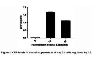 Interleukin-6 (IL-6), a pro-inflammatory cytokine and an anti-inflammatory myokine, plays important roles in the acute phase reaction, inflammation, hematopoiesis, bone metabolism, and cancer progression. (IL-6 Protein (AA 25-211) (His tag))