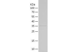 CHRNA7 Protein (AA 25-129) (His-IF2DI Tag)