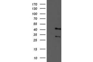 Western Blotting (WB) image for anti-Tropomodulin 1 (TMOD1) antibody (ABIN1501528) (Tropomodulin 1 抗体)