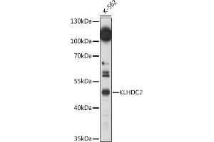 Western blot analysis of extracts of K-562 cells, using KLHDC2 antibody (ABIN7268073) at 1:1000 dilution. (KLHDC2 抗体  (AA 1-240))