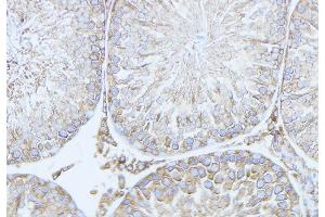 ABIN6279778 at 1/100 staining Mouse testis tissue by IHC-P. (RND2 抗体  (Internal Region))