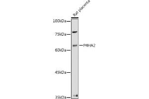 Western blot analysis of extracts of Rat placenta, using P4H antibody (ABIN1681193, ABIN3018745, ABIN3018746 and ABIN6220566) at 1:500 dilution.