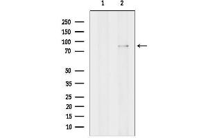 anti-gamma-Glutamyl Carboxylase (GGCX) (Internal Region) antibody