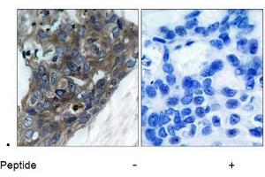 Image no. 1 for anti-Mitogen-Activated Protein Kinase Kinase Kinase 5 (MAP3K5) (Ser966) antibody (ABIN197326) (ASK1 抗体  (Ser966))