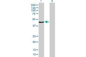 Western Blot analysis of PTPN2 expression in transfected 293T cell line by PTPN2 MaxPab polyclonal antibody. (PTPN2 抗体  (AA 1-387))