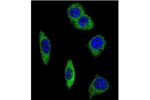Confocal immunofluorescent analysis of ADRA2B Antibody (Center)Cat.