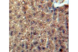 Used in DAB staining on fromalin fixed paraffin-embedded Liver tissue (CCL3L1 抗体  (AA 1-93))