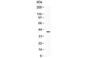 Western blot testing of mouse brain lysate with MC2R antibody at 0. (MC2R 抗体  (AA 268-297))