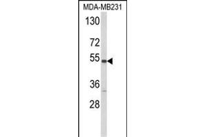Western blot analysis of CYP2A13 Antibody (C-term) (ABIN652591 and ABIN2842396) in MDA-M cell line lysates (35 μg/lane).
