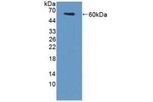 Detection of Recombinant TGM1, Mouse using Polyclonal Antibody to Transglutaminase 1 (TGM1) (TGM1 抗体  (AA 337-607))