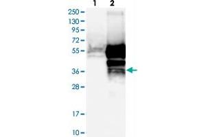 Western blot analysis of Lane 1: Negative control (vector only transfected HEK293T lysate), Lane 2: Over-expression Lysate (Co-expressed with a C-terminal myc-DDK tag (~3. (TMED8 抗体)