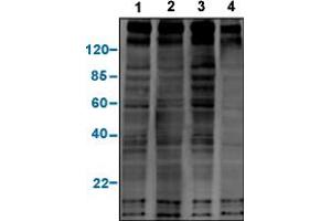 Western blot analysis of a panel of phosphotyrosine antibodies with EGF-stimulated A431 cell lysates. (Phosphotyrosine 抗体)