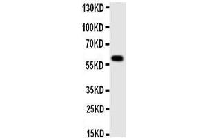 Western Blotting (WB) image for anti-Monoamine Oxidase A (MAOA) (AA 51-69), (N-Term) antibody (ABIN3043133) (Monoamine Oxidase A 抗体  (N-Term))