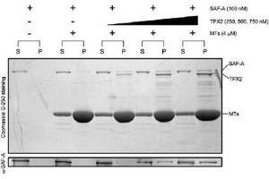 Activity Assay (AcA) image for TPX2, Microtubule-Associated, Homolog (Xenopus Laevis) (TPX2) (Active) protein (Myc-DYKDDDDK Tag) (ABIN2734107)