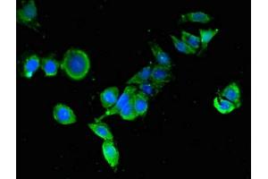 Immunofluorescence (IF) image for anti-Wingless-Type MMTV Integration Site Family, Member 5A (WNT5A) (AA 62-380) antibody (ABIN7166304)
