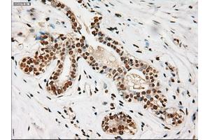 Immunohistochemical staining of paraffin-embedded breast using anti-Notch1 (ABIN2452671) mouse monoclonal antibody. (Notch1 抗体  (AA 2300-2556))