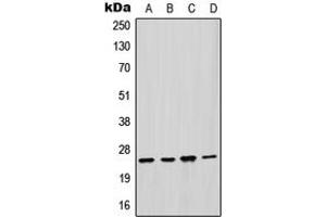 Western blot analysis of GSTM2 expression in HepG2 (A), HeLa (B), mouse liver (C), rat liver (D) whole cell lysates. (GSTM2 抗体  (Center))