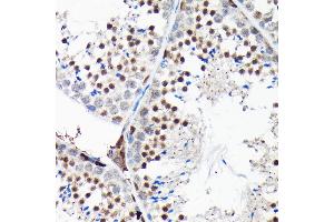 Immunohistochemistry of paraffin-embedded mouse testis using RGS14 Rabbit pAb (ABIN6130669, ABIN6146917, ABIN6146918 and ABIN6225301) at dilution of 1:100 (40x lens).