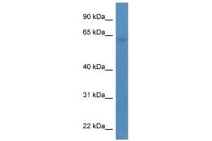 WB Suggested Anti-TBC1D10A Antibody Titration: 0. (TBC1D10A 抗体  (C-Term))