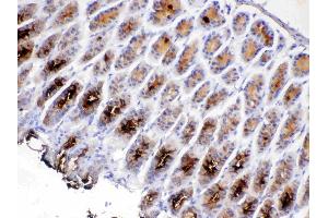 IHC analysis of TFF2 using anti-TFF2 antibody . (Trefoil Factor 2 抗体  (AA 24-129))