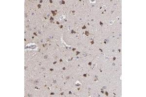 Immunohistochemical staining of human cerebral cortex with MAGEE1 polyclonal antibody  shows strong cytoplasmic positivity in neuronal cells at 1:20-1:50 dilution. (MAGEE1 抗体)