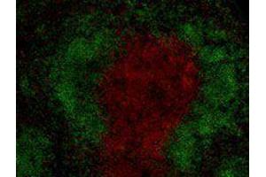 Immunofluorescence (IF) image for anti-CD3 (CD3) antibody (Alexa Fluor 594) (ABIN2656824) (CD3 抗体  (Alexa Fluor 594))