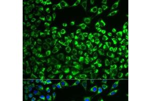 Immunofluorescence analysis of MCF-7 cells using CYP51A1 Polyclonal Antibody (CYP51A1 抗体)