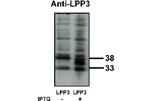 Western blot analysis using LPP3 antibody on bacterially expressed LPP3 protein when untreated (-) and treated with with 0. (PPAP2B 抗体)
