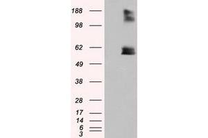 Image no. 2 for anti-Lipase, Endothelial (LIPG) antibody (ABIN1499175) (LIPG 抗体)