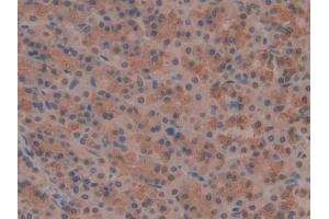Immunohistochemistry (IHC) image for anti-OTU Domain, Ubiquitin Aldehyde Binding 1 (OTUB1) (AA 1-271) antibody (ABIN1078419)