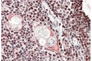 AP23696PU-N SATB1 Antibody staining of of paraffin embedded Human Thymus at 3. (SATB1 抗体  (Internal Region))