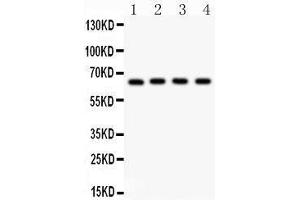 Anti- NF-kB p65 Picoband antibody, Western blotting All lanes: Anti NF-kB p65  at 0.