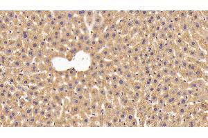 Detection of NNMT in Mouse Liver Tissue using Polyclonal Antibody to Nicotinamide-N-Methyltransferase (NNMT) (NNMT 抗体  (AA 1-264))
