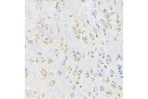 Immunohistochemistry of paraffin-embedded mouse brain using CHIC2 antibody at dilution of 1:100 (x40 lens). (CHIC2 抗体)