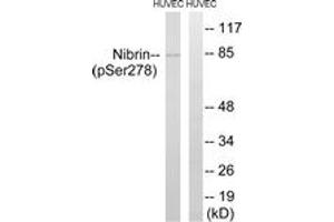 Western blot analysis of extracts from HuvEc cells treated with Forskolin 40nM 30', using Nibrin (Phospho-Ser278) Antibody. (Nibrin 抗体  (pSer278))